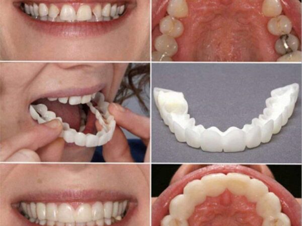 Silicone Imitation Braces Teeth Decoration Kits Environmentally Friendly And Safe Silicone Artificial Braces Snapon Smile